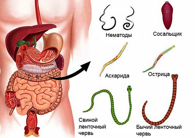 ПАРАЗИТАР ЭНТЕРОБИОЗ –  ҚУРТ КАСАЛЛИГИ ВА УНИНГ ПРОФИЛАКТИКА