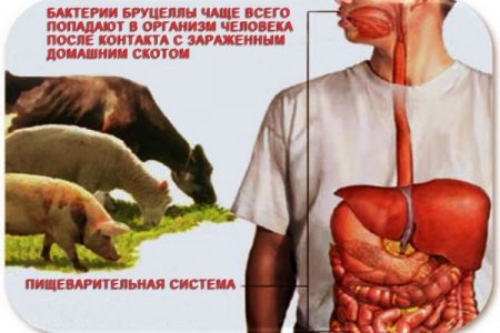 БРУЦЕЛЛЁЗ ҲАЙВОНЛАРГА ХОС КАСАЛЛИК, ЛЕКИН ИНСОНГА ҲАМ ЮҚИШИ 